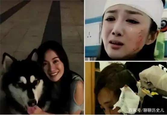 被称为古装第一美人李依晓被狗咬到毁容整容后仍难翻身