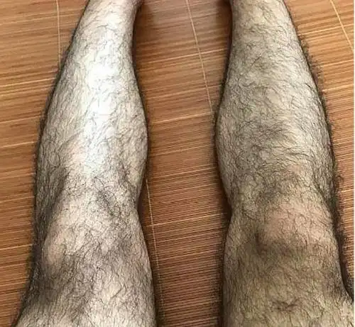 为什么有的男性腿毛浓密有的男性腿光秃秃原因只有一点
