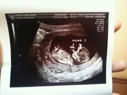 8月5日晚,周家蔚通过新浪微博正式公布已怀孕的消息,并发出一张婴儿的