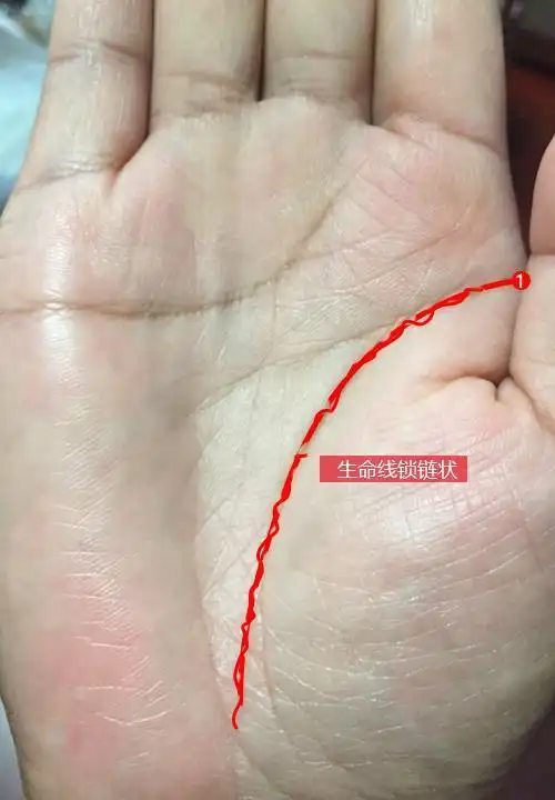 生命线的起点一带,金星丘上部是和胃部相对应的,是胃部在手相