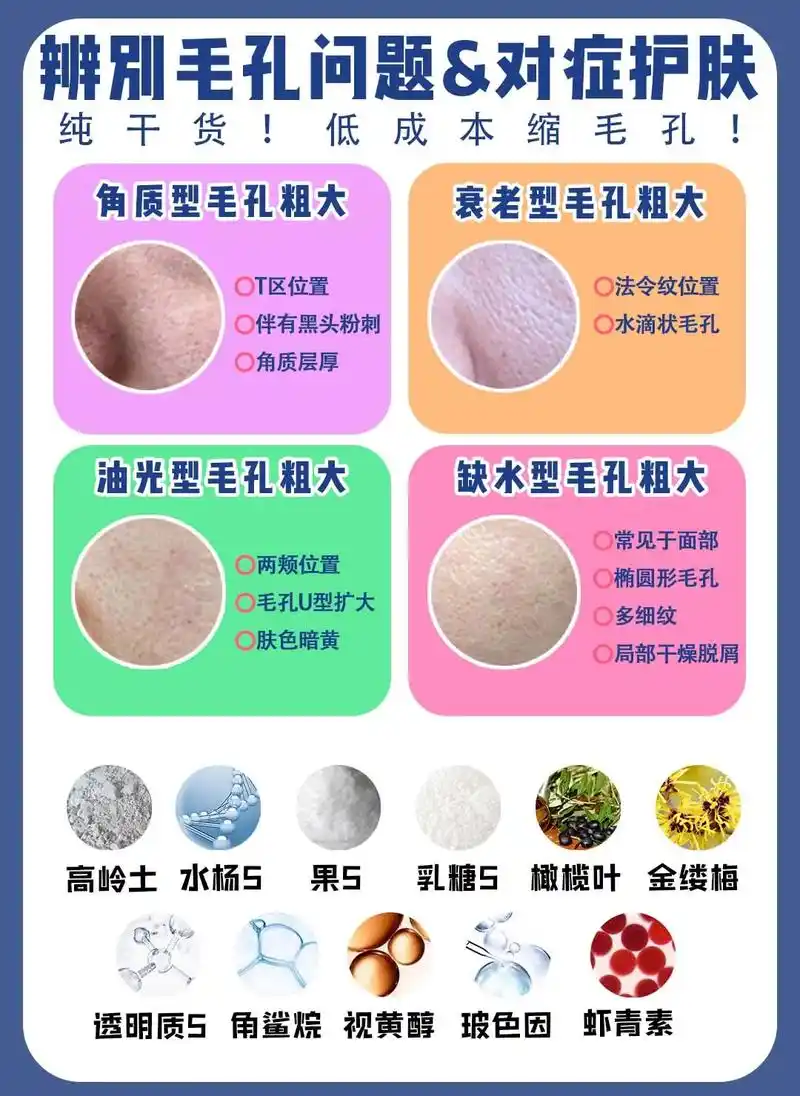 你是哪种?你的皮肤是不是毛孔粗大?像月 - 抖音