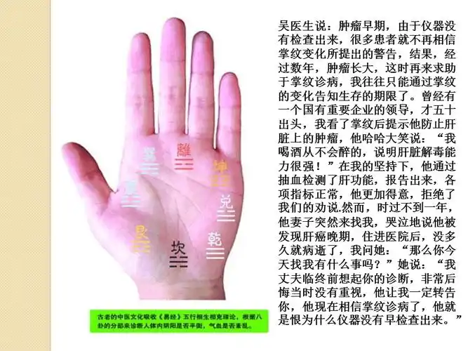 注意掌纹透露的癌症信号ppt