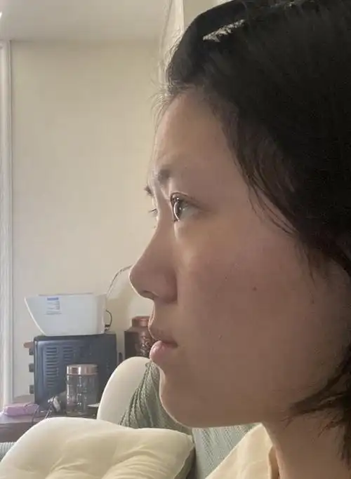 感觉自己侧脸不好看但是不知道什么原因希望能有人解答一下