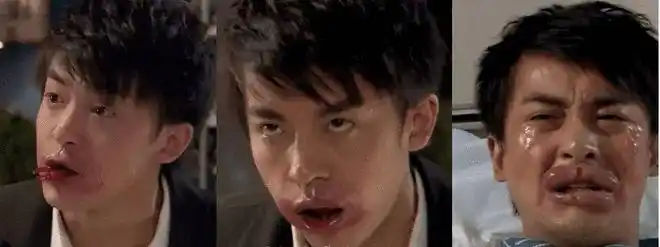 男童闻鱼腥味过敏致死!过敏非小事,这篇文章请务必收藏|过敏原|过敏性