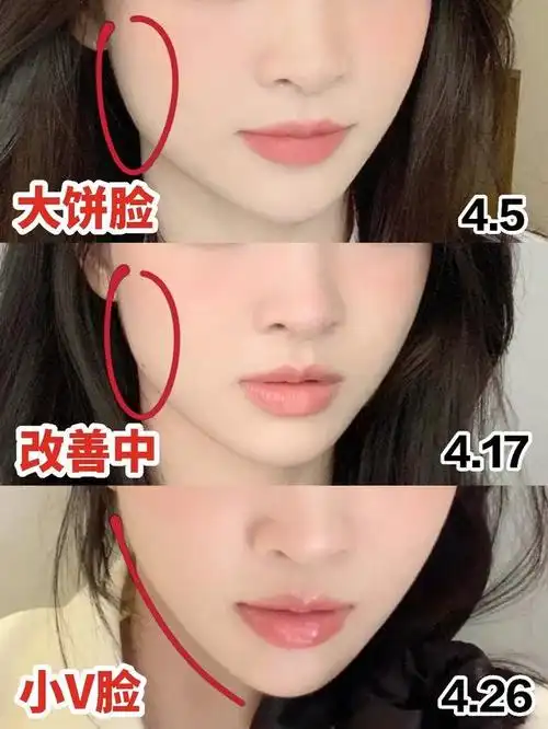 大饼脸的救星!如何科学瘦咬肌?