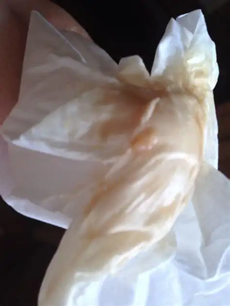 白带异常吃什么才会好