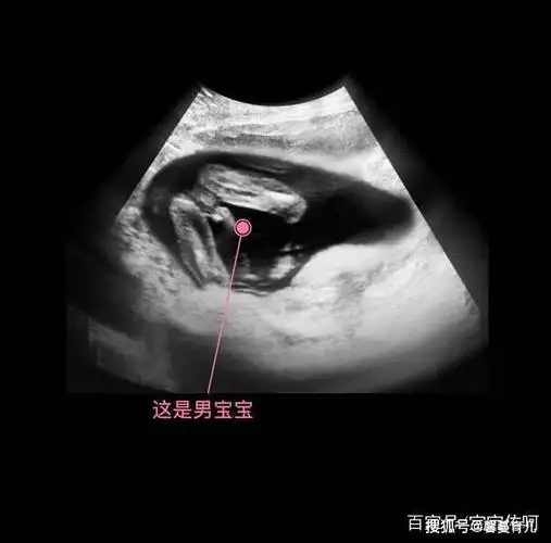 胎儿从卵泡到性别形成17张图片清晰诠释男宝女宝看得很清楚