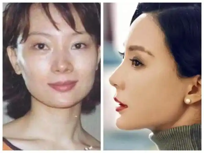 来看一张陈数的早期旧照,总体来说眉清目秀,气质成熟_圈子-新氧美容