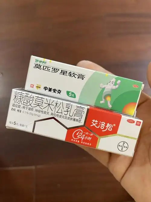 湿疹药膏