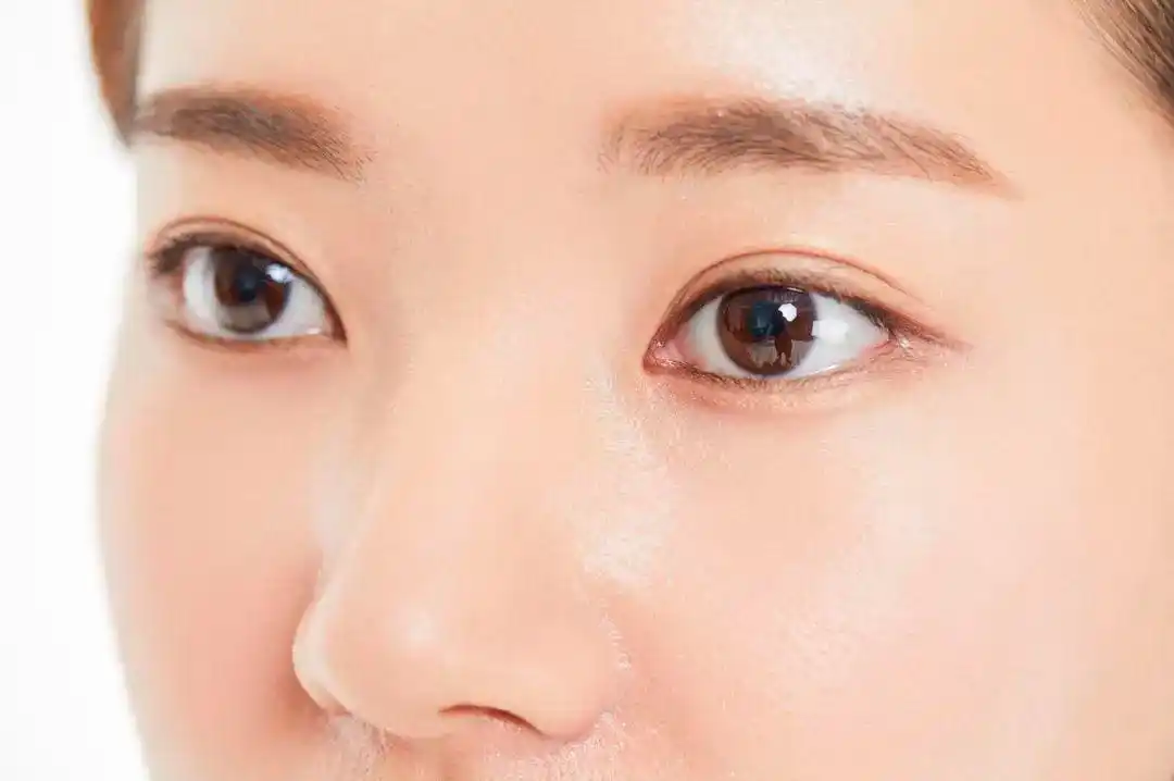 想割双眼皮有一个问题要先搞清楚