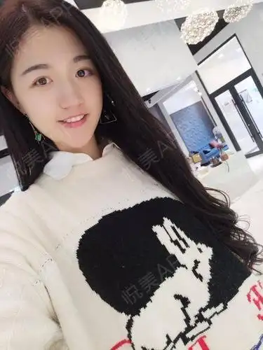 自体脂肪面部填充术后7天_面部填充术后7天_自体脂肪术后7天_面部轮廓