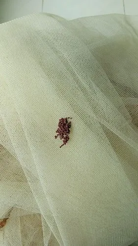 谁知道这是什么虫卵