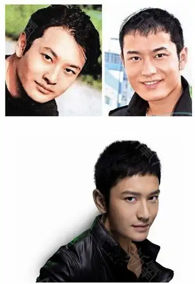 潍坊botox瘦脸针神奇老少皆宜 黄晓明整容疯传网上