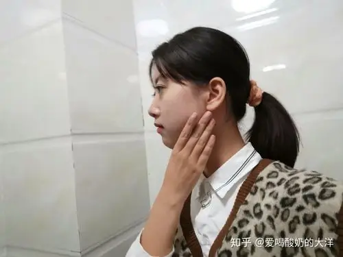 有没有侧脸不是很好看 正脸却很好看的人?