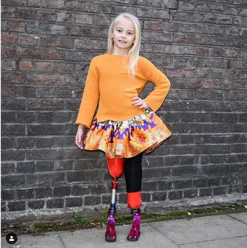 双义肢9岁女孩将亮相纽约时装周 amputated girl to walk the runway