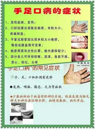 超前幼儿园手足口病预防宣传保健知识