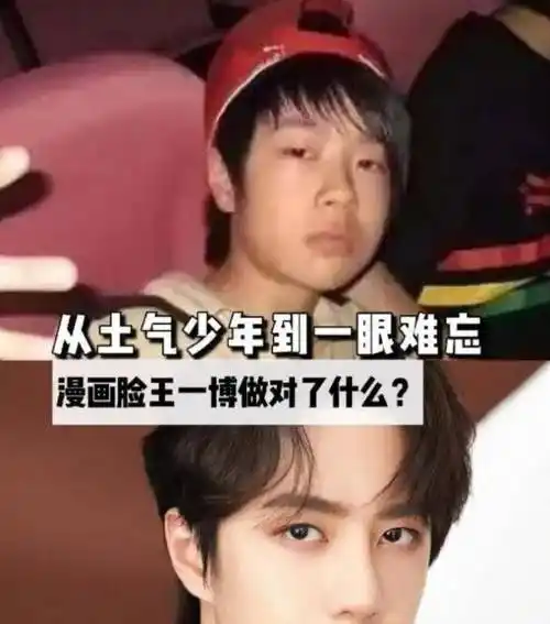 8位改头换命的男明星王一博脸已僵硬刘恺威眼皮才是灵魂