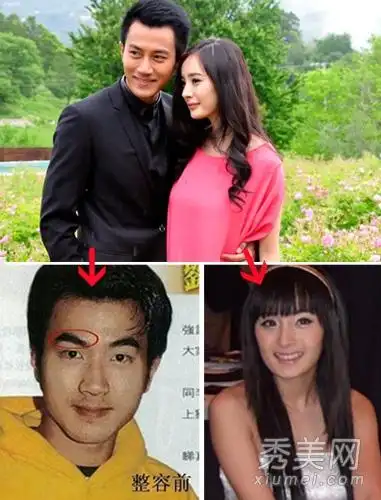 黄晓明刘恺威郭敬明土鳖成型男 整容变帅的男星(图)