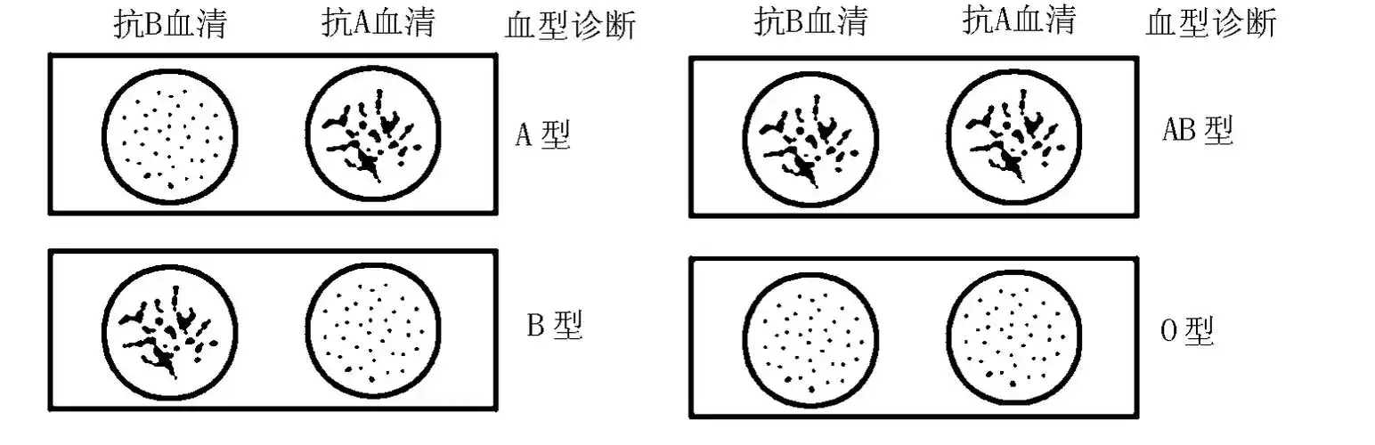 rh血型和abo血型能互相输血吗