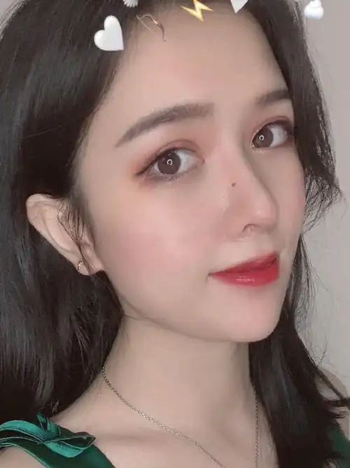 一直想要一个高挺的鼻梁,拍照会更上镜,这次做完了鼻_圈子-新氧美容整