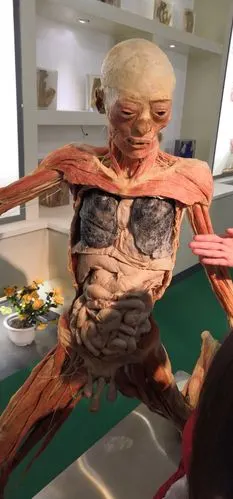 这个标本更是神奇,直观展示了吸烟者的肺!