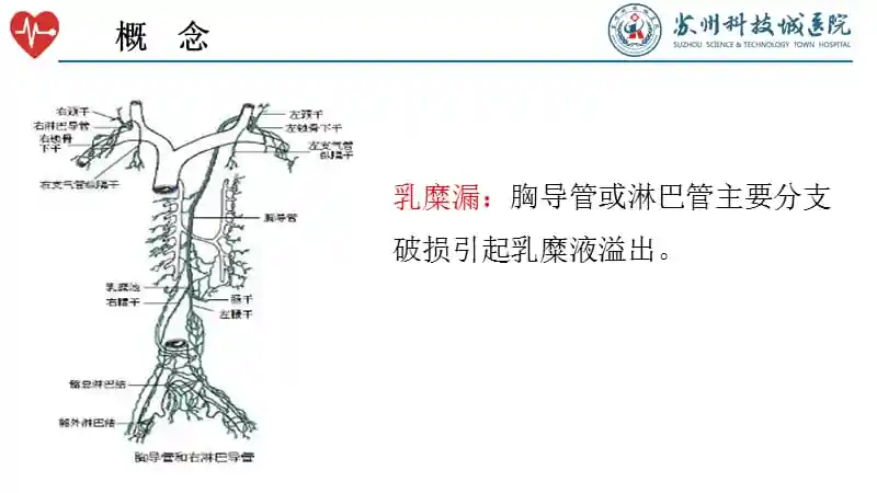 甲状腺术后淋巴漏的护理推荐课件