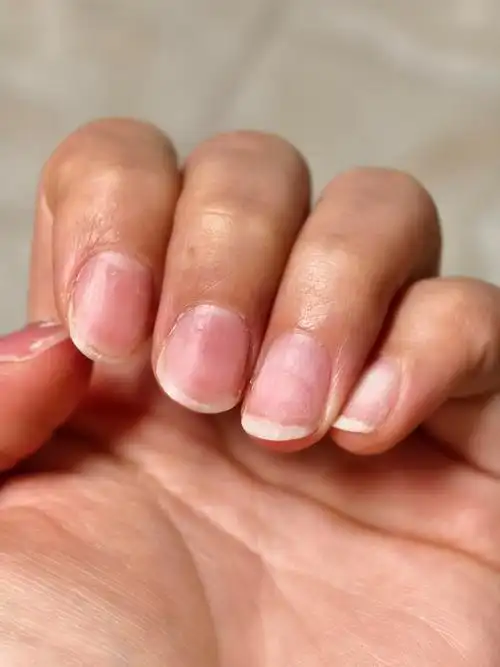 扇形指甲,甲床短,宽,怎么养啊啊啊?