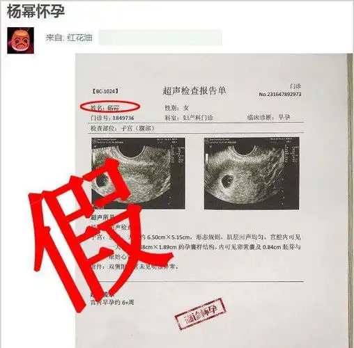 捏造杨幂怀孕的假b超单还在传播,她忙于拍戏晒漫画腰秒破传闻