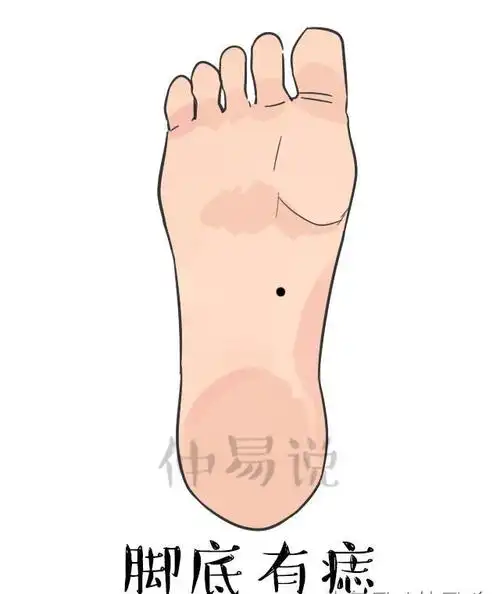 身体上最有福气的痣,你有哪几颗?