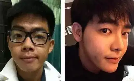 泰国小哥花74万整容从丑男变网红!
