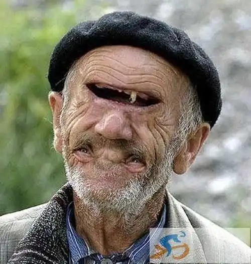 最恶心的图片头像图片_头像图片_扣扣乐园