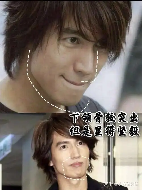 的下颌骨发育有点过度,过宽且方,造成了国字脸,加上颧骨夕不勺因素