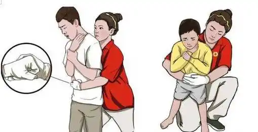 这个拥抱能救命人人必学的海姆立克急救法