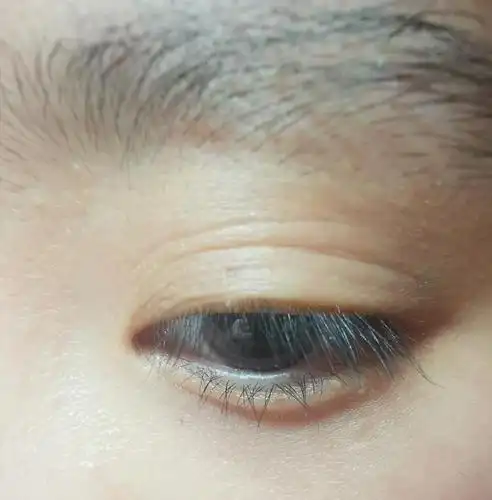 有没有和我一样多层眼皮的姐妹