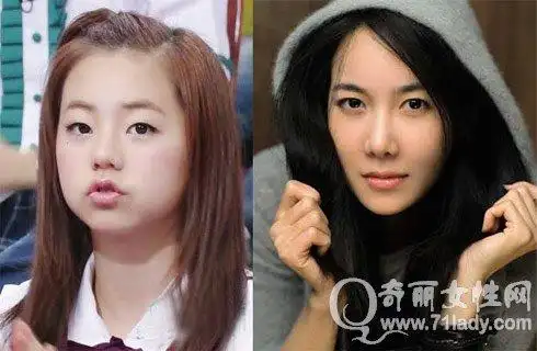 李智雅被曝整容 李智雅整容前后对比照片