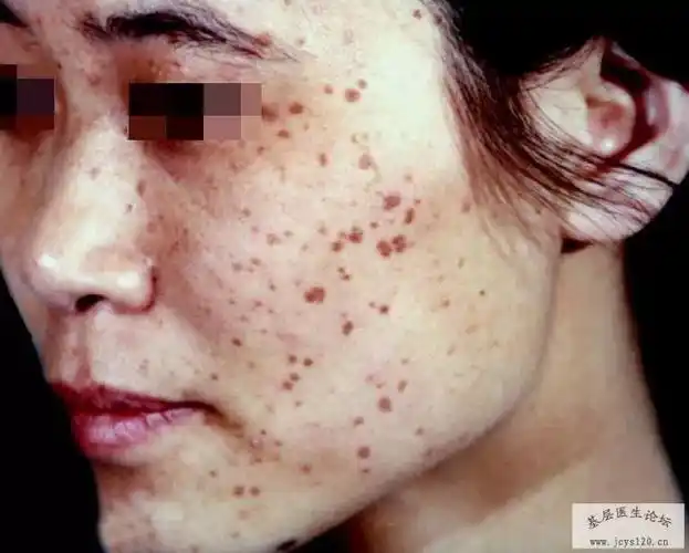 皮肤病图各种皮肤病的图片难得啊