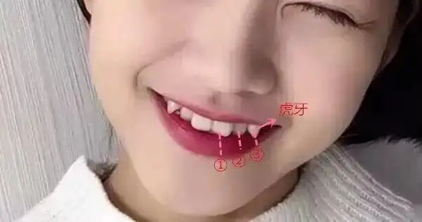 虎牙也叫犬齿(捂脸),从门牙数起的第三颗牙齿(3号牙),又被称为尖牙或