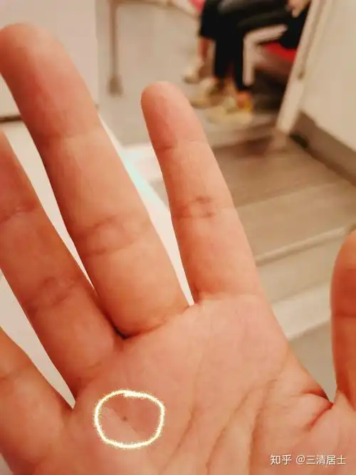 女生左手心靠近虎口处有痣就代表着这是一个很厉害的女人,如果他的