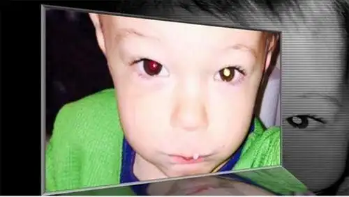 宝宝的眼睛有秘密,如果孩子出现这5种"怪眼",家长一定要警惕