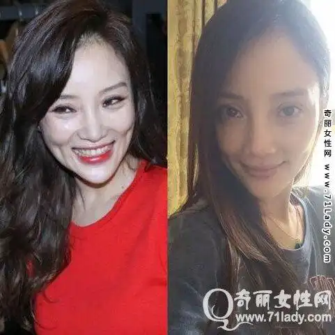 李小璐整容前后素颜照对比