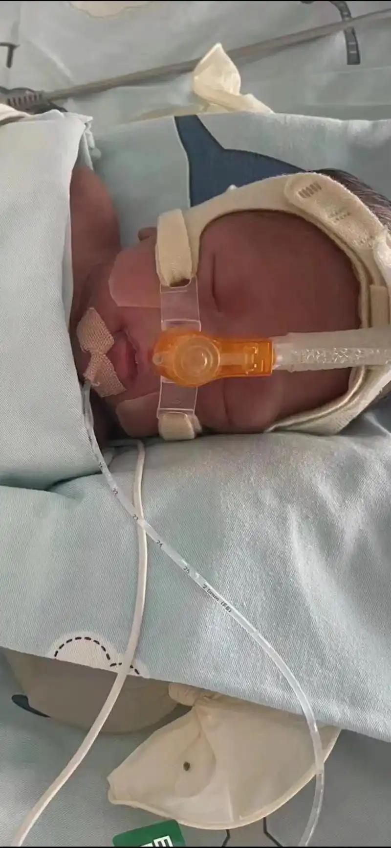 26周早产双胞胎宝宝第四十七天.哈哈今天给个特写镜头,好可爱 - 抖音