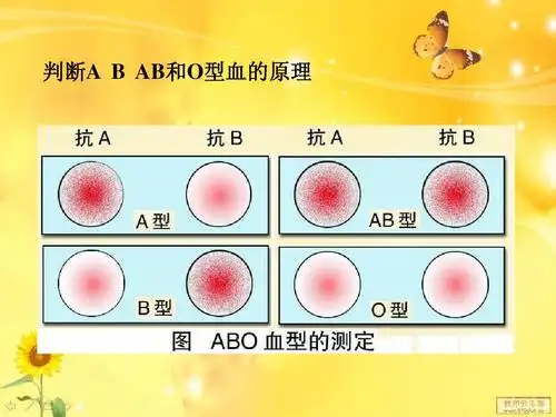 abo血型的鉴定ppt
