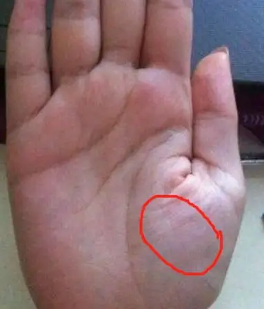 拇指升起的小地方在手相学上叫金星丘.