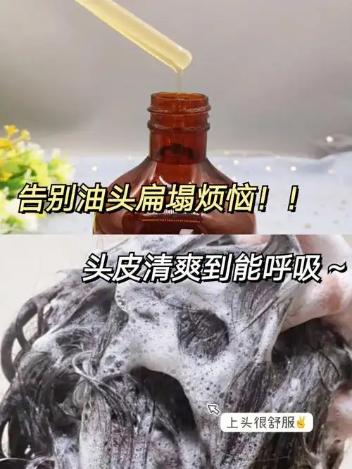 头发终于不油了介洗发水控油蓬松