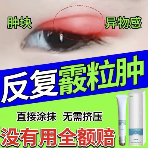 眼睑炎红肿 【发新包装】3盒【疗程装】