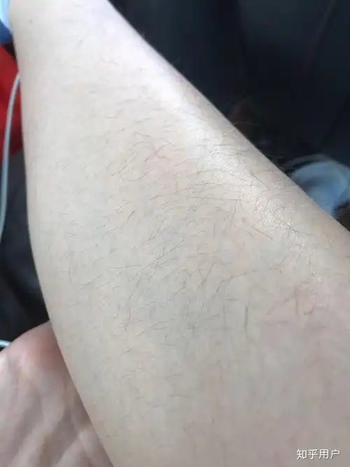 女生腿毛超多是一种什么样的体验