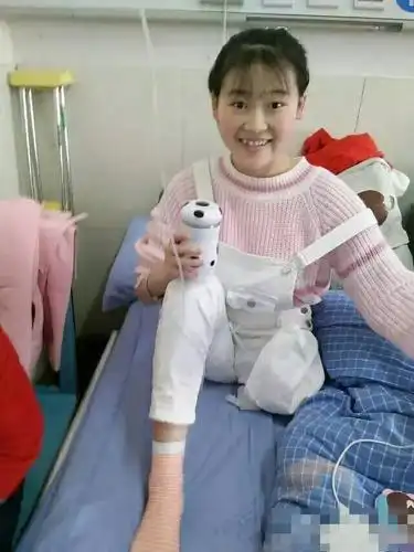 四川巴中独腿患癌19岁女孩:请帮我捐眼角膜!