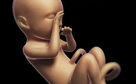 胎位roa是什么意思 roa是什么胎位图片-思宇生活