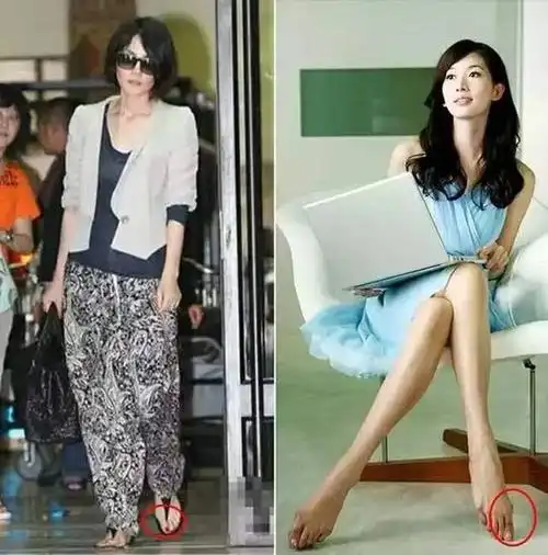 学会驾驭它才能穿到老呀|高跟鞋|拇指外翻|王菲_新浪时尚_新浪网