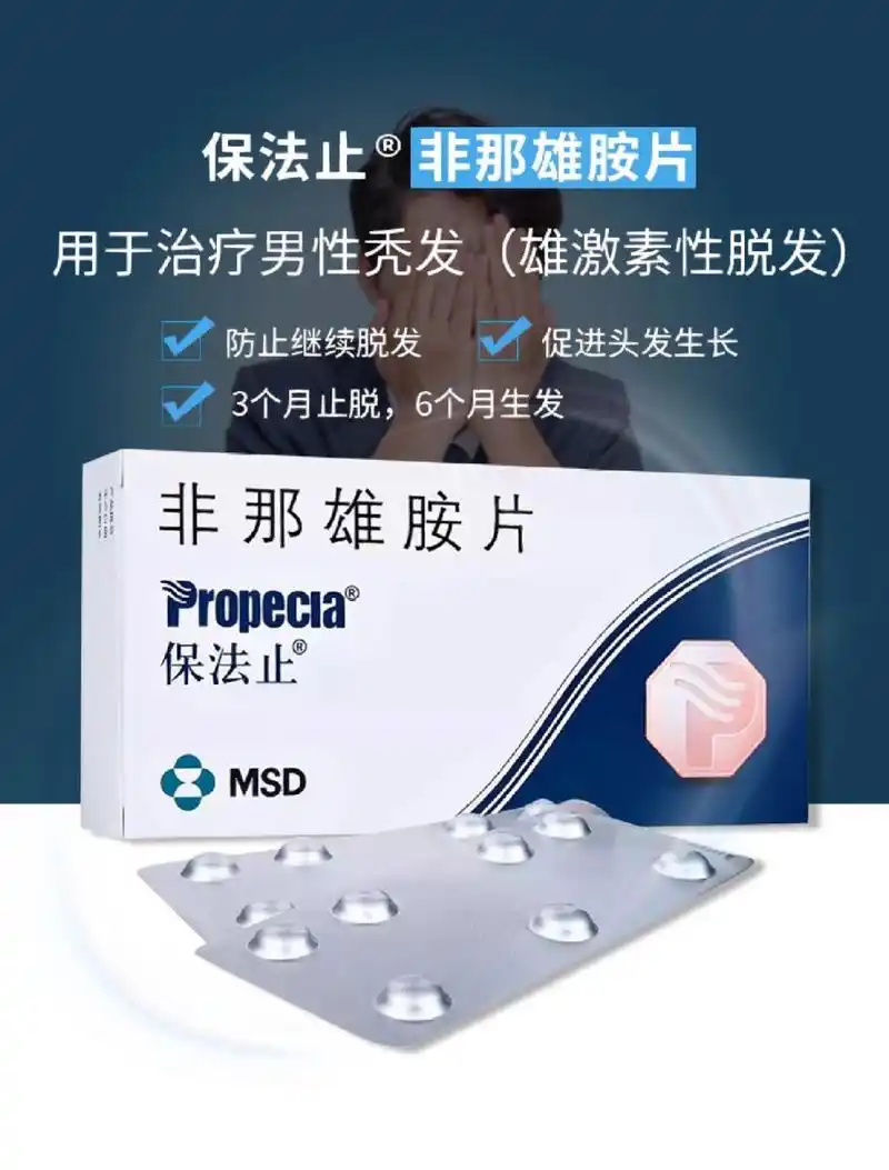 雄性脱发改选择哪个牌子非那雄胺 非那雄胺我1mg的